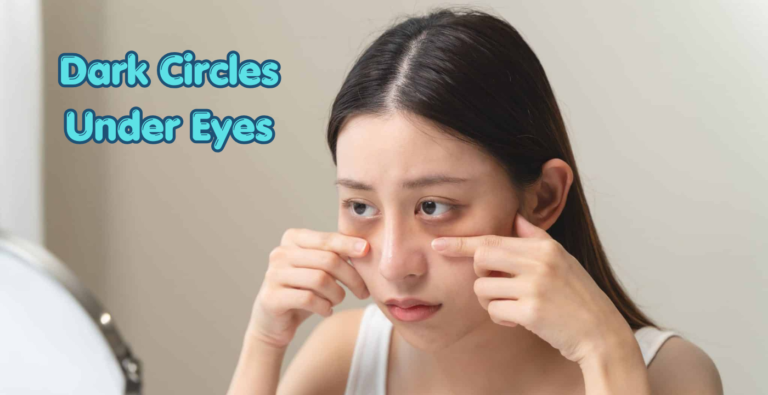 Dark Circles Under Eyes: Simple Ways to Reduce Their Appearance Dark Circles Under Eyes: Simple Ways to Reduce Their Appearance